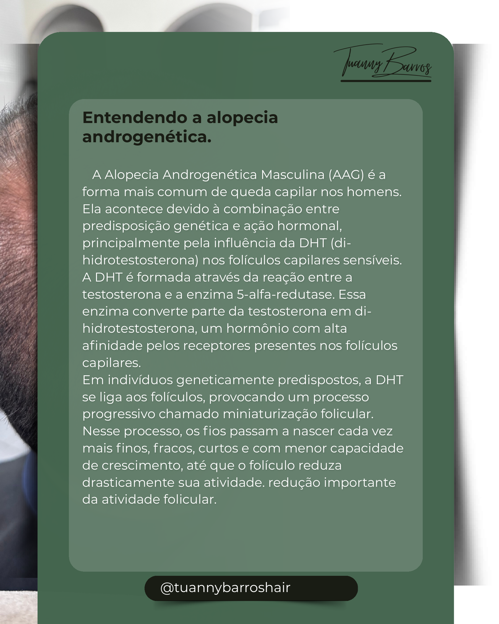 Entendendo a Alopecia